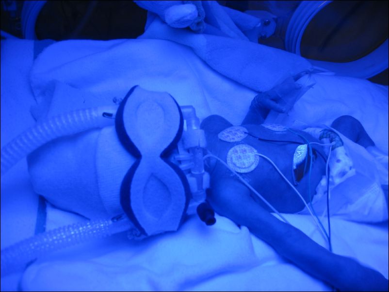 Owen Under Blue Lights